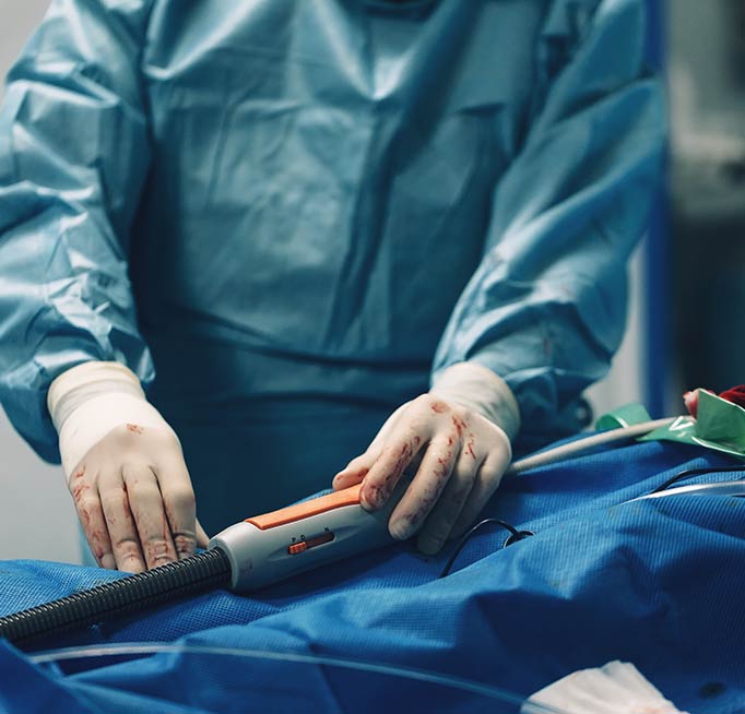 Surgeon using the stent delivery system